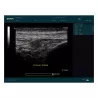 ECHOGRAPHE DUS60 AVEC 1 SONDE EDAN