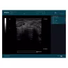 ECHOGRAPHE DUS60 AVEC 1 SONDE EDAN