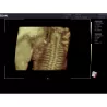 ECHOGRAPHE COULEUR 3D/4D ACLLRAIX LX28 + 1 SONDE