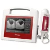 BLADDER SCANNER VITASCAN + TABLETTE DP + PIED
