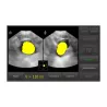 BLADDER SCANNER VITASCAN + TABLETTE DP + PIED