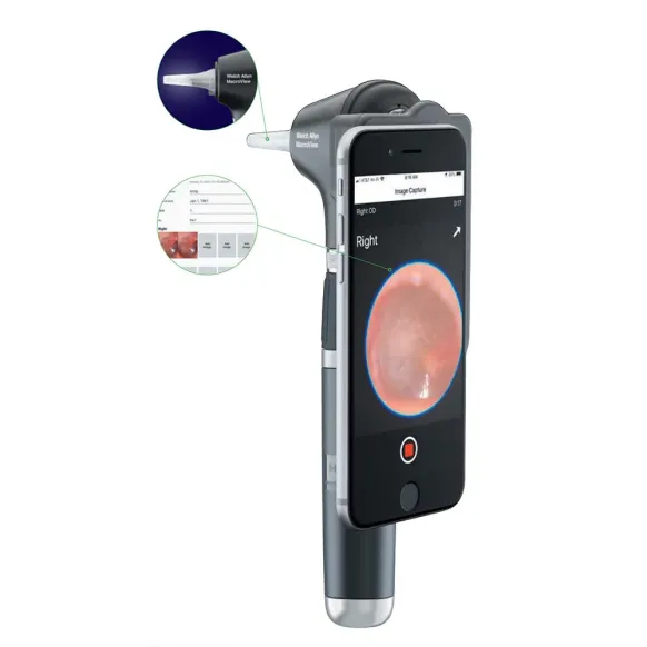 SET MACROVIEW 2 PLUS IEXAMINER - HILL ROM WELCH ALLYN