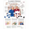 PLANCHES ANATOMIQUES MALADIE D'ALZHEIMER