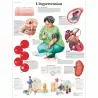 PLANCHES ANATOMIQUES HYPERTENSION