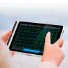 TABLETTE ECG 10 POUCES 12 PISTES AVEC BASE IMPRIMANTE