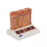MODÈLE DE CANCER DE LA PEAU