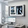 NÉGATOSCOPE LED EXTRA-PLAT  2 PLAGES