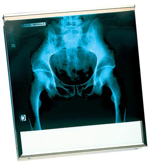 NÉGATOSCOPE