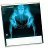 NÉGATOSCOPE
