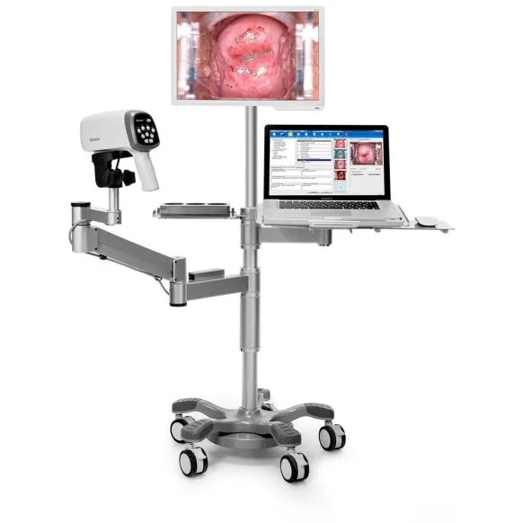 VIDÉO COLPOSCOPE C3A