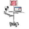 VIDÉO COLPOSCOPE C3A