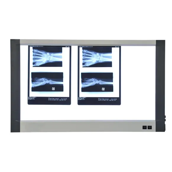 NEGATOSCOPE LED EXTRA-PLAT 3 PLAGES.