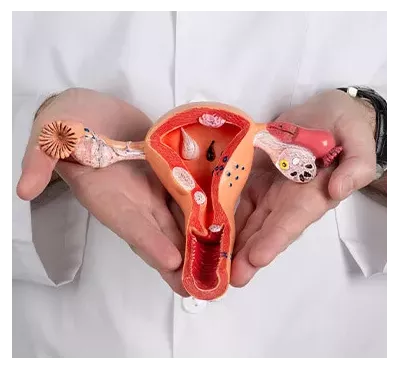 Matériel de gynécologie : Catalogue pour professionnels | Drexco Medical